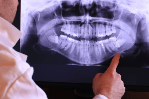 Best Broken or Cracked Tooth Emergency Dentist in Grasonville, MD