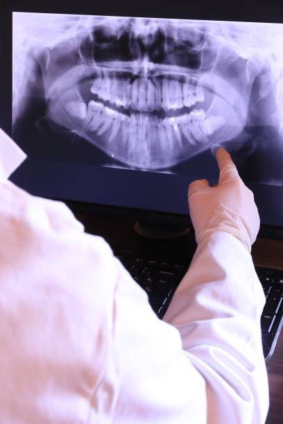 Best Emergency Root Canal Treatment in Grasonville, MD