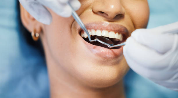 Best Weekend Emergency Dentist in Grasonville, MD