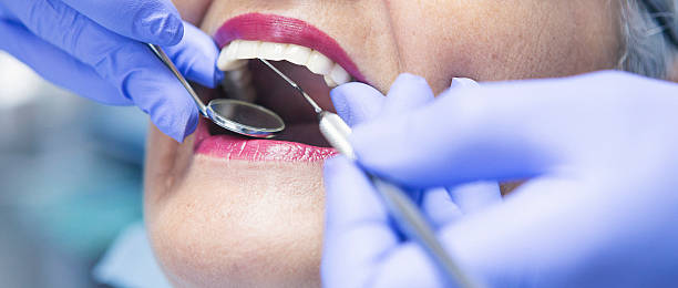 Best Orthodontic Emergency Dentist in Grasonville, MD